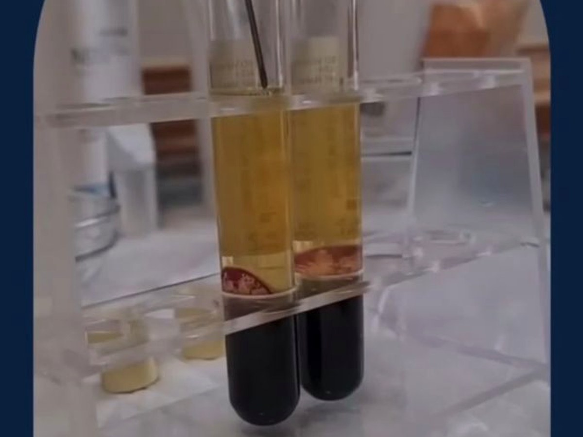 Plasma rico en plaquetas para medicina regenerativa